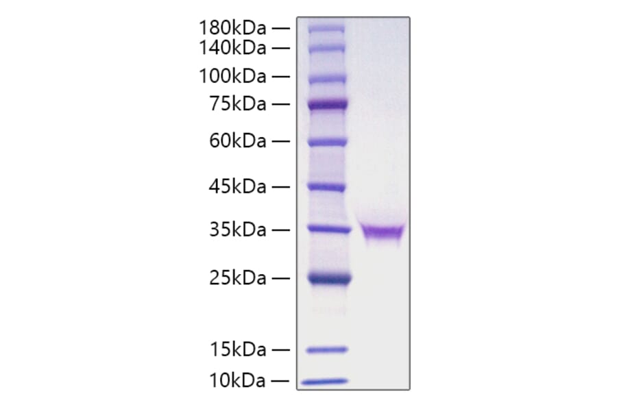 SDS-PAGE - Recombinant Human FGF18 Protein (C-terminal His Tag) (A330624) - Antibodies.com