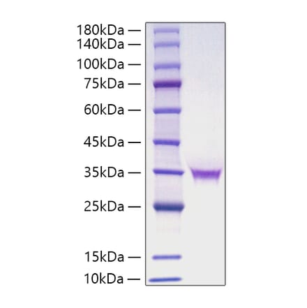 SDS-PAGE - Recombinant Human FGF18 Protein (C-terminal His Tag) (A330624) - Antibodies.com