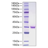 SDS-PAGE - Recombinant Human FGF18 Protein (C-terminal His Tag) (A330624) - Antibodies.com