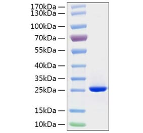 SDS-PAGE - Recombinant Human FGF19 Protein (C-terminal His Tag) (A330625) - Antibodies.com