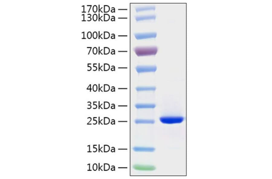 SDS-PAGE - Recombinant Human FGF19 Protein (C-terminal His Tag) (A330625) - Antibodies.com