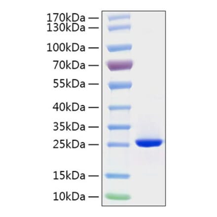 SDS-PAGE - Recombinant Human FGF19 Protein (C-terminal His Tag) (A330625) - Antibodies.com
