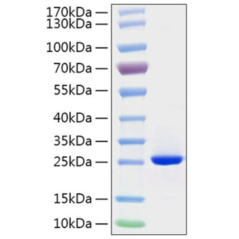 SDS-PAGE - Recombinant Human FGF19 Protein (C-terminal His Tag) (A330625) - Antibodies.com