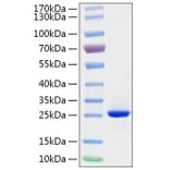 SDS-PAGE - Recombinant Human FGF19 Protein (C-terminal His Tag) (A330625) - Antibodies.com