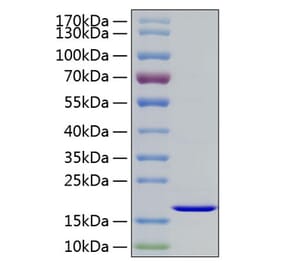 SDS-PAGE - Recombinant Human FGF2 Protein (A330626) - Antibodies.com