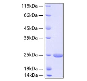 SDS-PAGE - Recombinant Human FGF21 Protein (A330627) - Antibodies.com