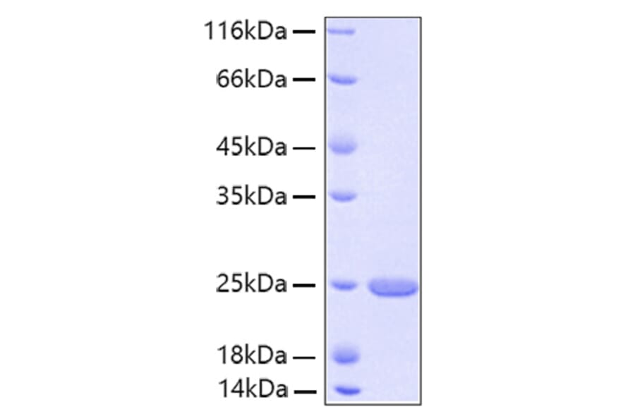 SDS-PAGE - Recombinant Human FGF21 Protein (A330627) - Antibodies.com
