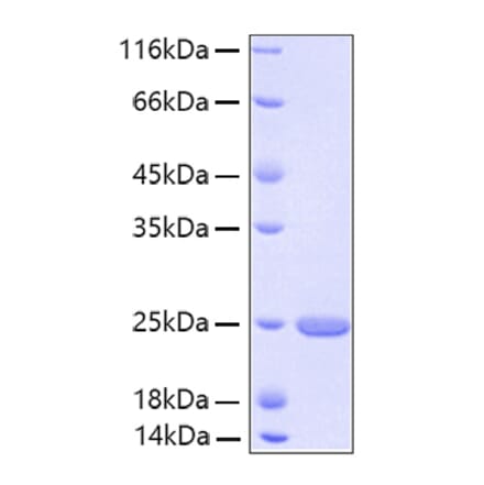 SDS-PAGE - Recombinant Human FGF21 Protein (A330627) - Antibodies.com