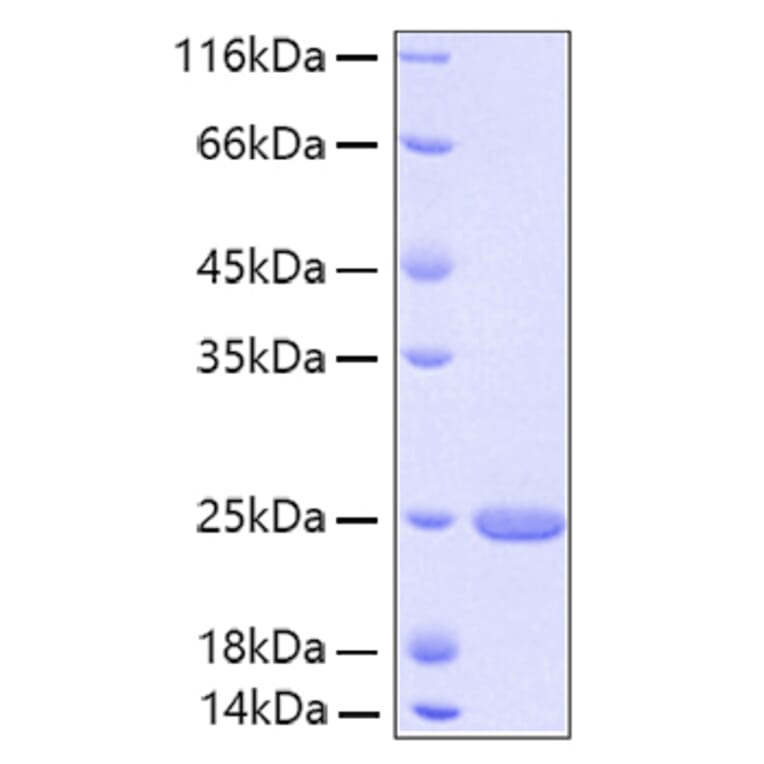 SDS-PAGE - Recombinant Human FGF21 Protein (A330627) - Antibodies.com