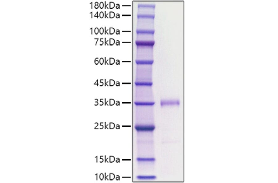 SDS-PAGE - Recombinant human FGF23 Protein (C-terminal His Tag) (A330628) - Antibodies.com