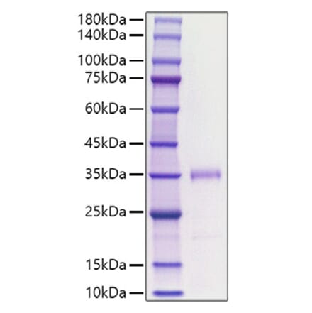 SDS-PAGE - Recombinant human FGF23 Protein (C-terminal His Tag) (A330628) - Antibodies.com