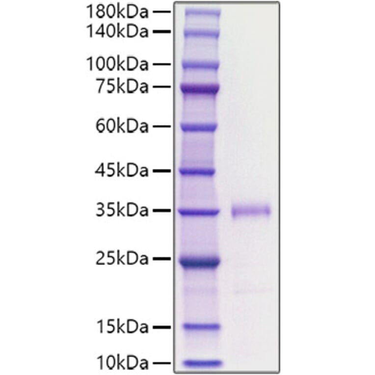 SDS-PAGE - Recombinant human FGF23 Protein (C-terminal His Tag) (A330628) - Antibodies.com