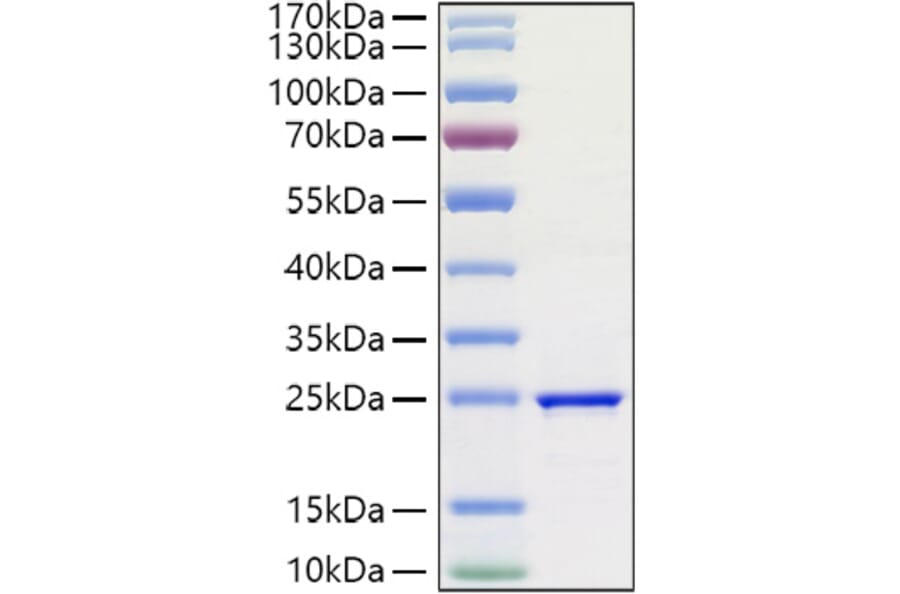 SDS-PAGE - Recombinant Human FGF3 Protein (A330629) - Antibodies.com