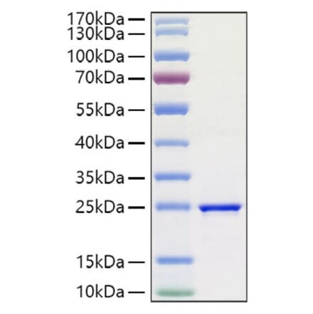 SDS-PAGE - Recombinant Human FGF3 Protein (A330629) - Antibodies.com