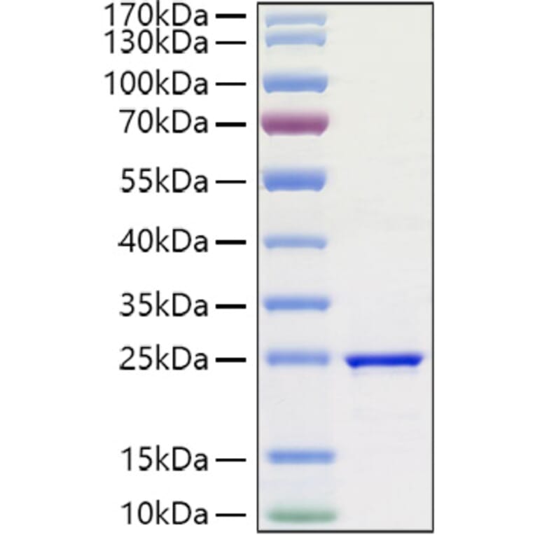 SDS-PAGE - Recombinant Human FGF3 Protein (A330629) - Antibodies.com