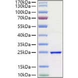SDS-PAGE - Recombinant Human FGF3 Protein (A330629) - Antibodies.com