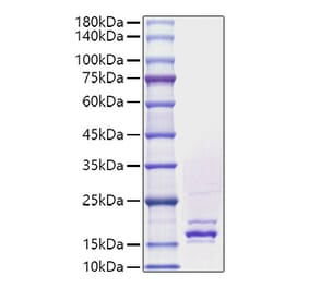 SDS-PAGE - Recombinant Human FGF4 Protein (A330630) - Antibodies.com