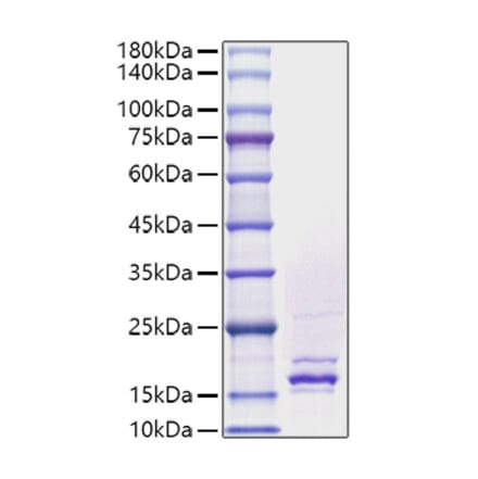 SDS-PAGE - Recombinant Human FGF4 Protein (A330630) - Antibodies.com