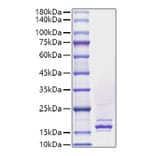 SDS-PAGE - Recombinant Human FGF4 Protein (A330630) - Antibodies.com