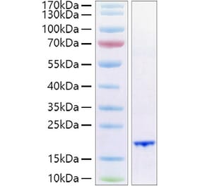 SDS-PAGE - Recombinant Human FGF6 Protein (A330631) - Antibodies.com