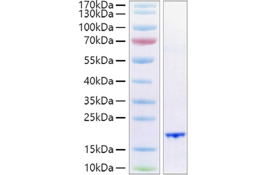 SDS-PAGE - Recombinant Human FGF6 Protein (A330631) - Antibodies.com