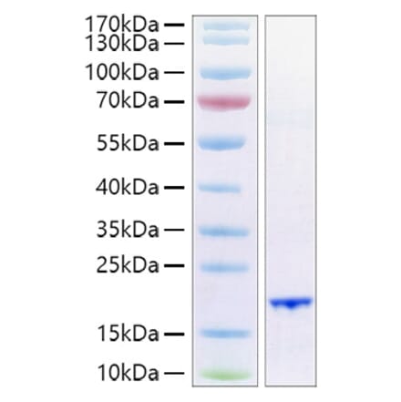 SDS-PAGE - Recombinant Human FGF6 Protein (A330631) - Antibodies.com