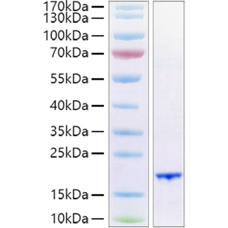 SDS-PAGE - Recombinant Human FGF6 Protein (A330631) - Antibodies.com