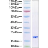 SDS-PAGE - Recombinant Human FGF6 Protein (A330631) - Antibodies.com