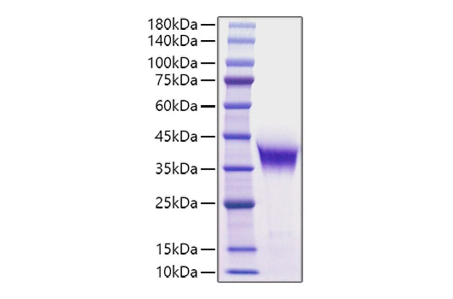 SDS-PAGE - Recombinant Human/Mouse FGF8 Protein (C-terminal His Tag) (A330632) - Antibodies.com