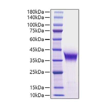 SDS-PAGE - Recombinant Human/Mouse FGF8 Protein (C-terminal His Tag) (A330632) - Antibodies.com