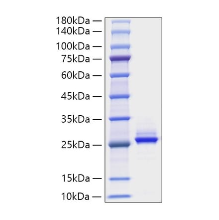 SDS-PAGE - Recombinant Human FGF9 Protein (A330633) - Antibodies.com