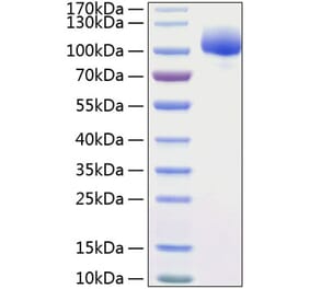 SDS-PAGE - Recombinant Human FGFR1 Protein (C-terminal Human Fc and His Tag) (A330634) - Antibodies.com