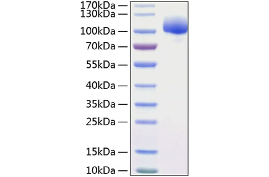 SDS-PAGE - Recombinant Human FGFR1 Protein (C-terminal Human Fc and His Tag) (A330634) - Antibodies.com