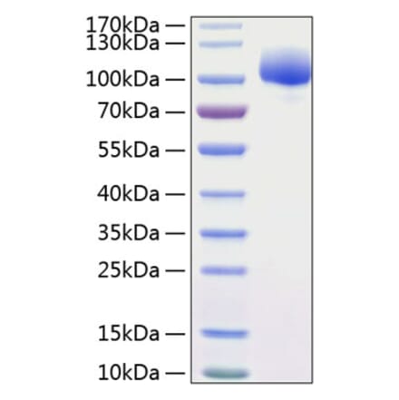 SDS-PAGE - Recombinant Human FGFR1 Protein (C-terminal Human Fc and His Tag) (A330634) - Antibodies.com