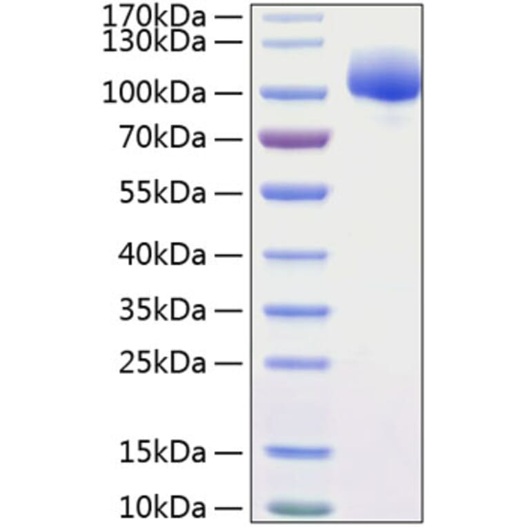 SDS-PAGE - Recombinant Human FGFR1 Protein (C-terminal Human Fc and His Tag) (A330634) - Antibodies.com