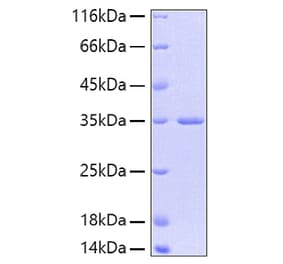 SDS-PAGE - Recombinant Human FGFR2 Protein (A330635) - Antibodies.com