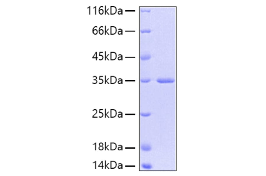 SDS-PAGE - Recombinant Human FGFR2 Protein (A330635) - Antibodies.com