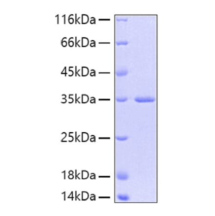 SDS-PAGE - Recombinant Human FGFR2 Protein (A330635) - Antibodies.com