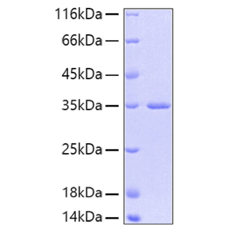 SDS-PAGE - Recombinant Human FGFR2 Protein (A330635) - Antibodies.com