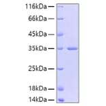 SDS-PAGE - Recombinant Human FGFR2 Protein (A330635) - Antibodies.com