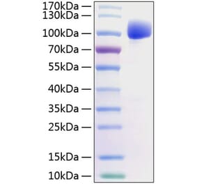 SDS-PAGE - Recombinant Human FGFR2 Protein (C-terminal Human Fc and His Tag) (A330636) - Antibodies.com
