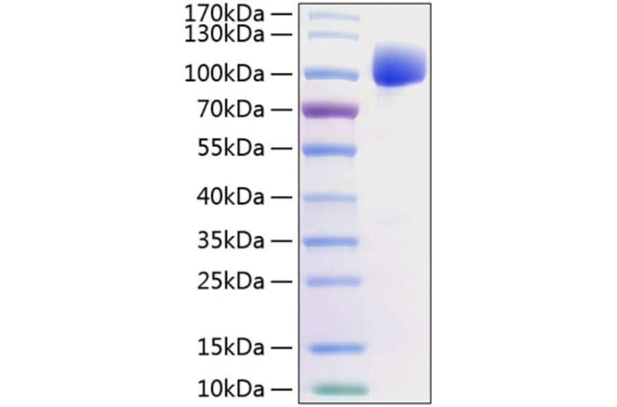 SDS-PAGE - Recombinant Human FGFR2 Protein (C-terminal Human Fc and His Tag) (A330636) - Antibodies.com