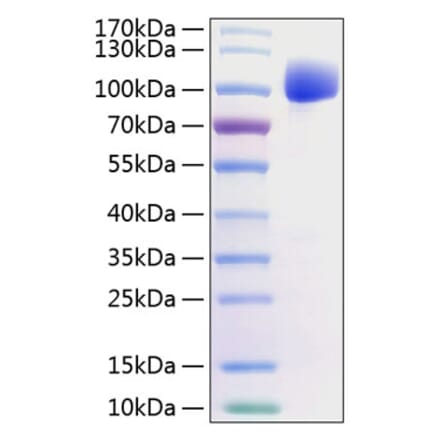SDS-PAGE - Recombinant Human FGFR2 Protein (C-terminal Human Fc and His Tag) (A330636) - Antibodies.com