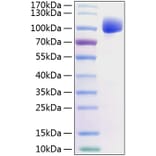 SDS-PAGE - Recombinant Human FGFR2 Protein (C-terminal Human Fc and His Tag) (A330636) - Antibodies.com
