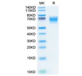 Tris-Bis PAGE - Recombinant Human FGFR2 Protein (C-terminal His Tag) (A330637) - Antibodies.com
