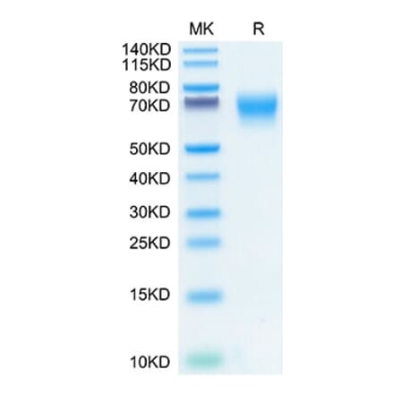 Tris-Bis PAGE - Recombinant Human FGFR2 Protein (C-terminal His Tag) (A330637) - Antibodies.com