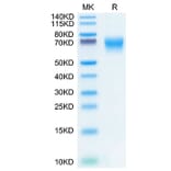 Tris-Bis PAGE - Recombinant Human FGFR2 Protein (C-terminal His Tag) (A330637) - Antibodies.com