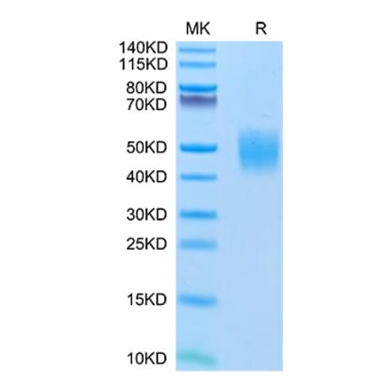 Tris-Bis PAGE - Recombinant Human FGFR2 Protein (C-terminal His Tag) (A330638) - Antibodies.com