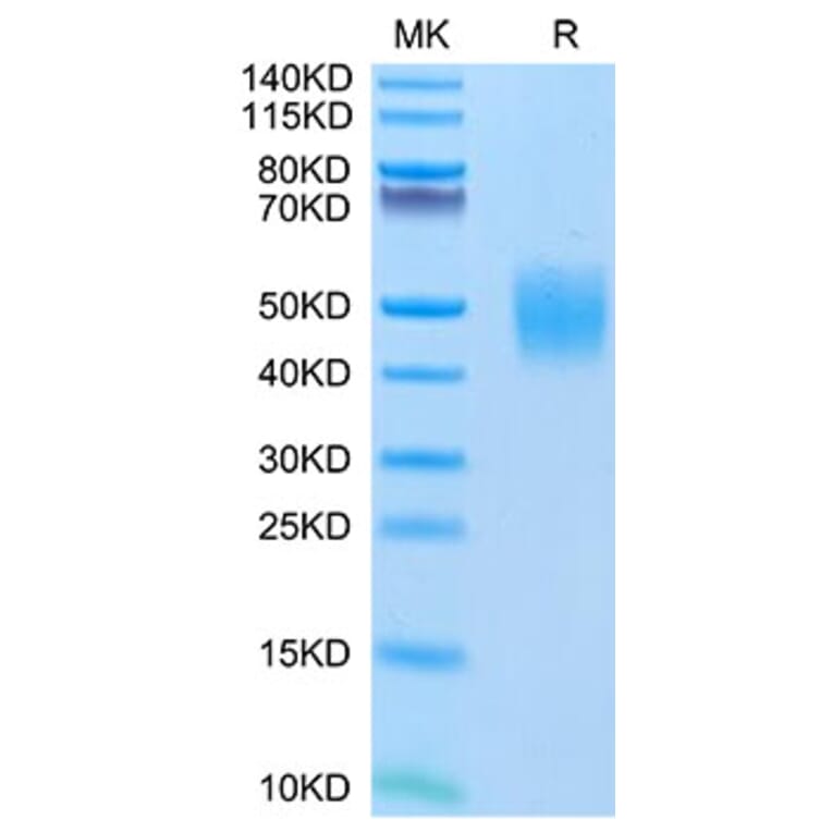 Tris-Bis PAGE - Recombinant Human FGFR2 Protein (C-terminal His Tag) (A330638) - Antibodies.com