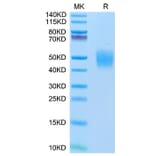 Tris-Bis PAGE - Recombinant Human FGFR2 Protein (C-terminal His Tag) (A330638) - Antibodies.com
